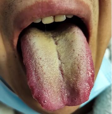 3个中成药精准去湿热，不做油腻中年人