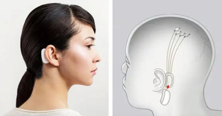 瑞士瘫痪男子,马斯克人脑接口芯片