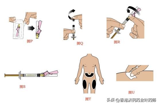 真性红细胞增多症长效干扰素BESREMi使用指南、注意事项