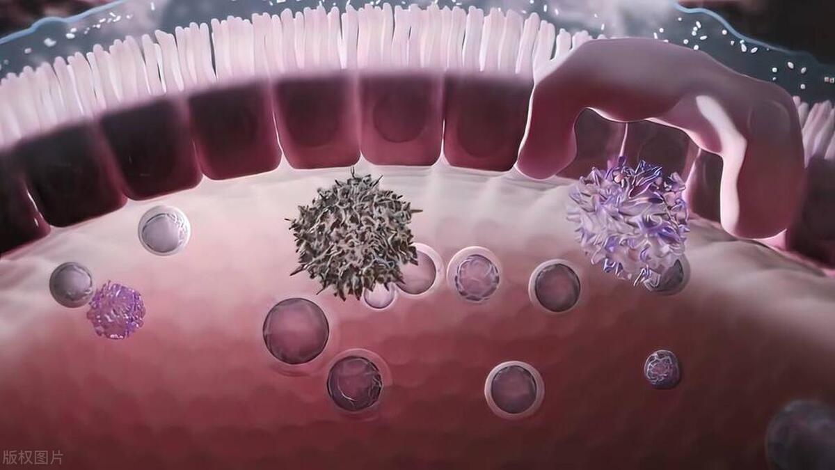 白癜风病因检测的重要性你知道吗,医生详解白癜风治疗中的注意事项