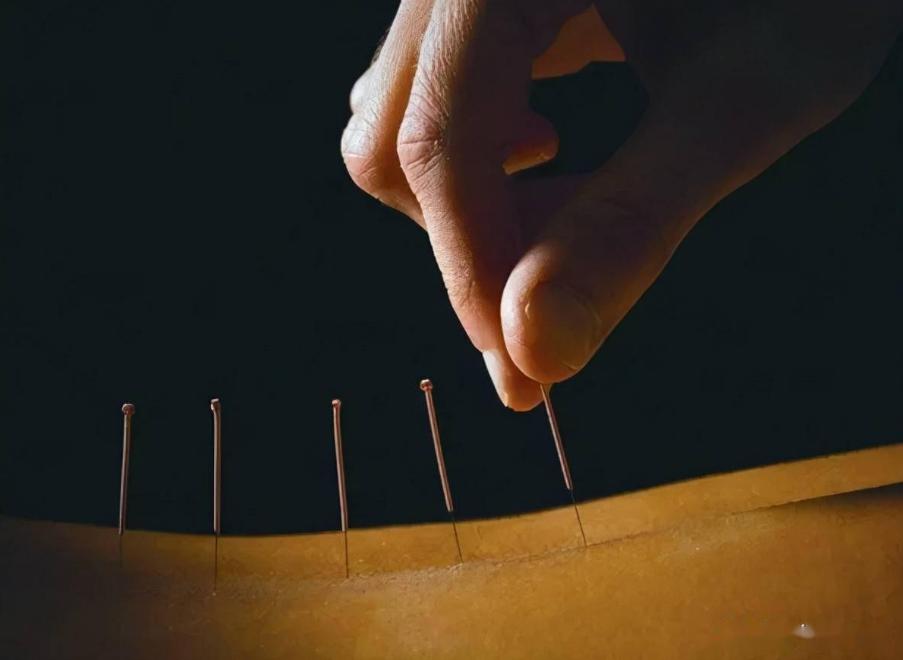 日本针灸铜人,日本古代铜人针灸