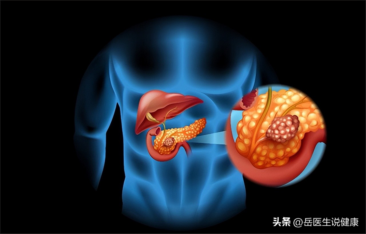 保护胰腺，就是守住我们的生命线，保护胰腺，要从这几件小事做起