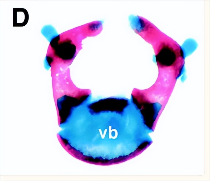 探讨胶原蛋白II在软骨中表达，对于去除节弦中异位变化