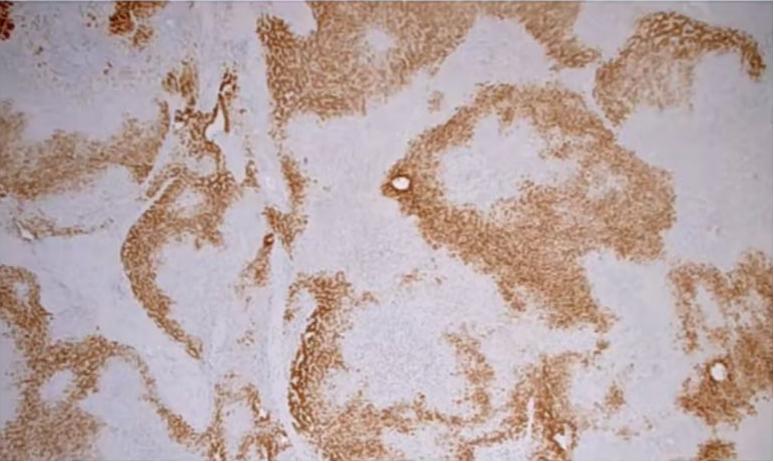 肝囊肿和肝占位影像学鉴别,杨永峰医生个人简历