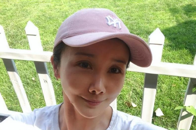 整容整毁的女明星对比照,整容失败女明星今昔对比