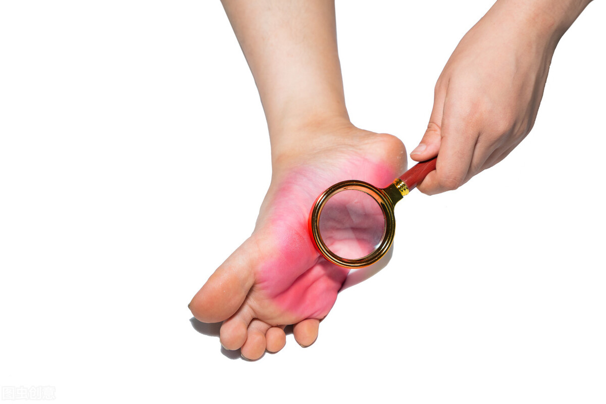 怎样治灰指甲不走弯路,灰指甲治好了就是正常的指甲了吗