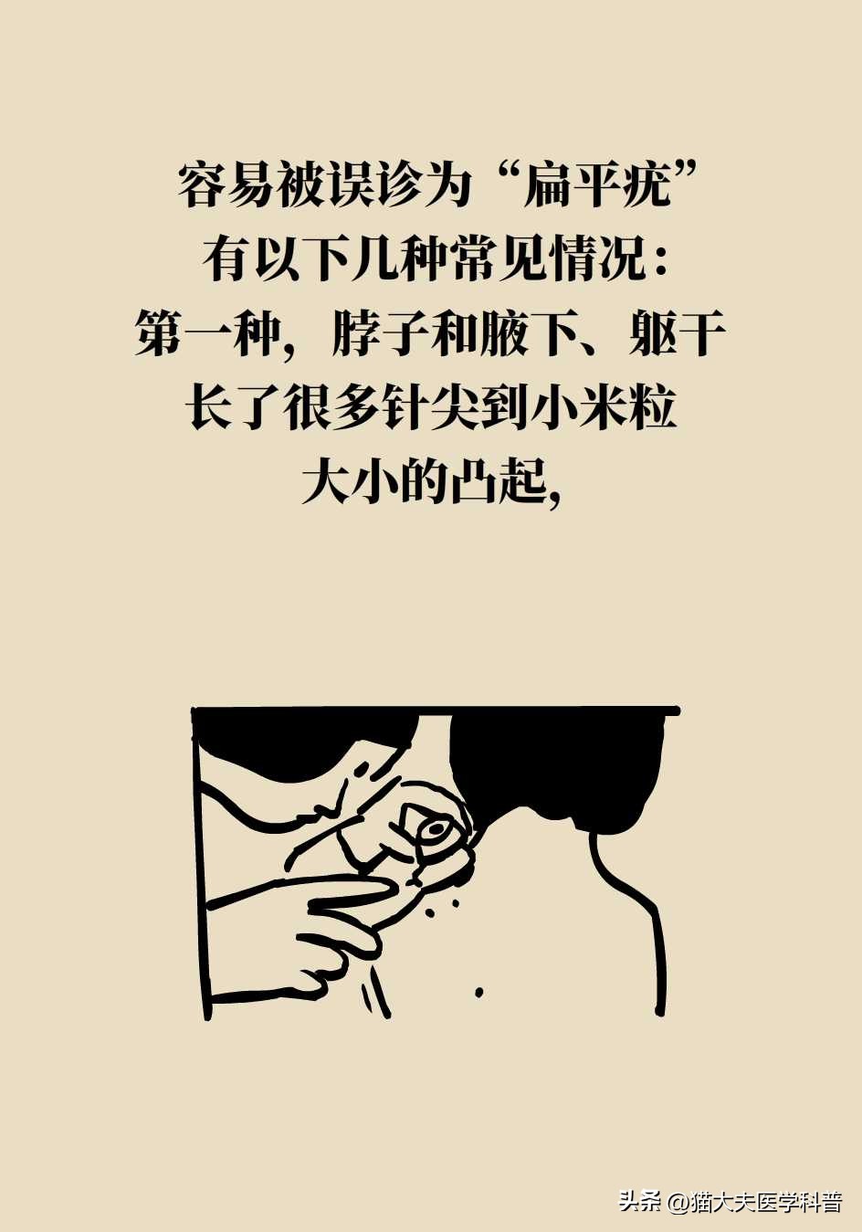 脖子上长的小肉揪怎么治啊,疣丝是不是脖子上的小肉粒