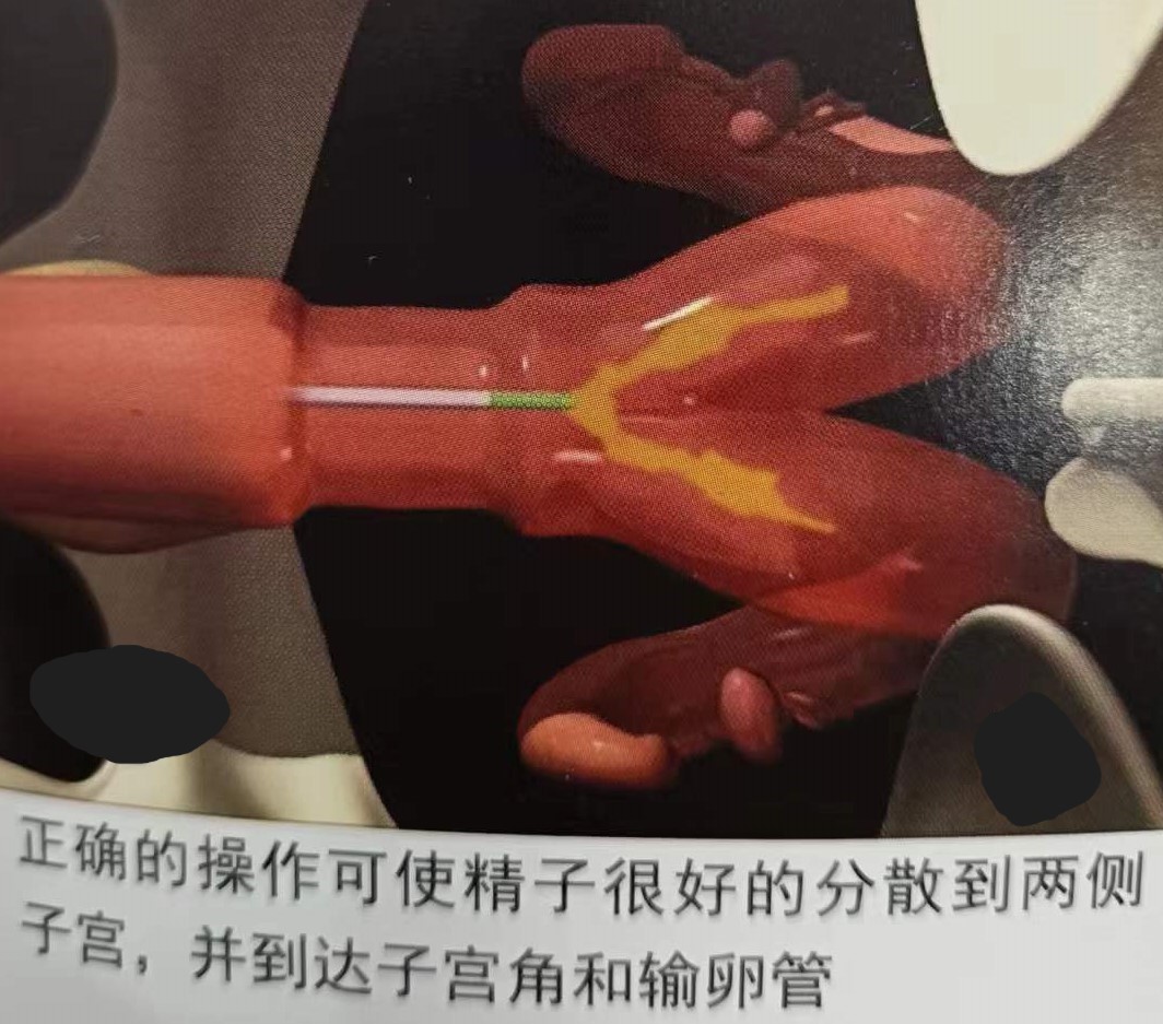 如何提高母牛同期的繁育能力,如何提高母牛受孕率