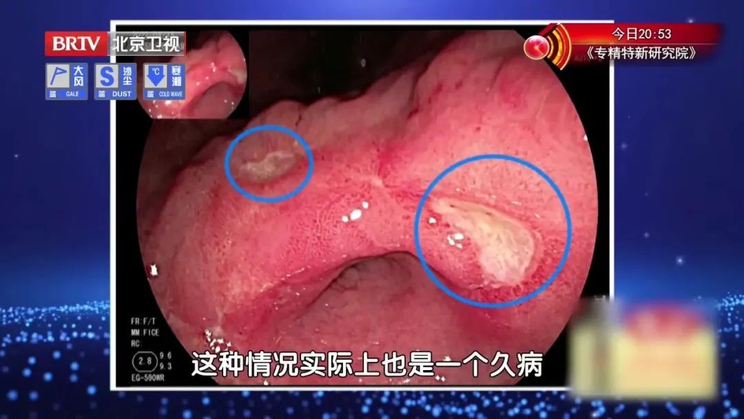 去胃火养脾胃喝什么茶最好,哪些养生茶对胃好