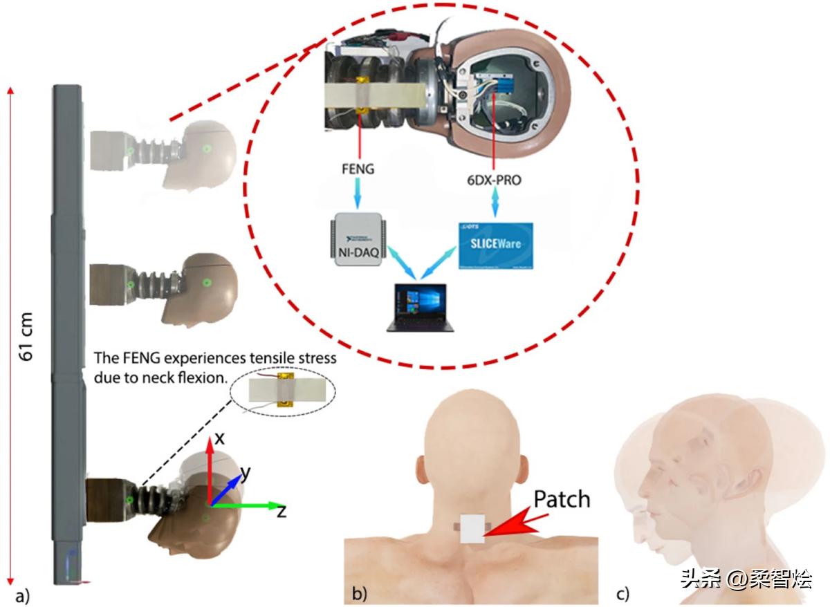 颈戴式“绷带”传感器可以更好地检测脑震荡损伤