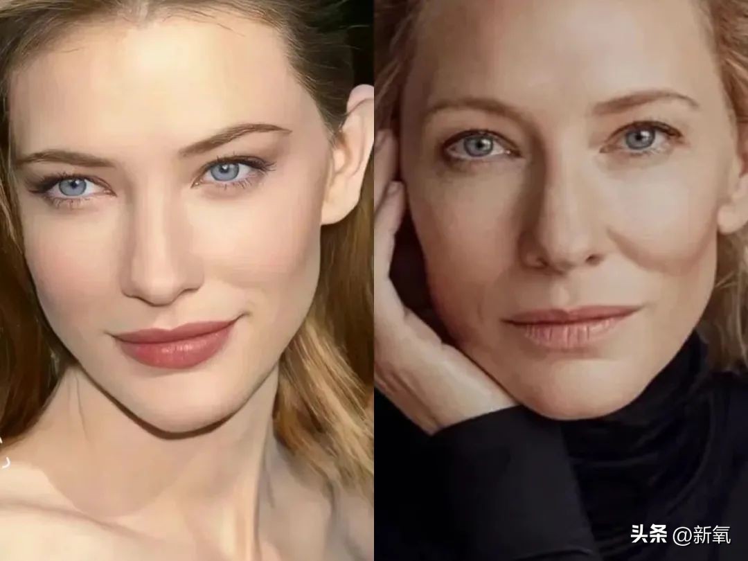 嘴唇薄变丰满,嘴唇变凸变丑怎么办