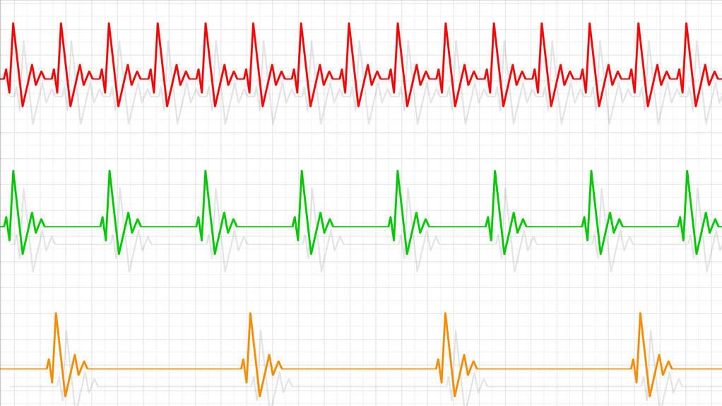 1岁小孩心跳快是什么原因,儿童室上速心率过速怎么治疗