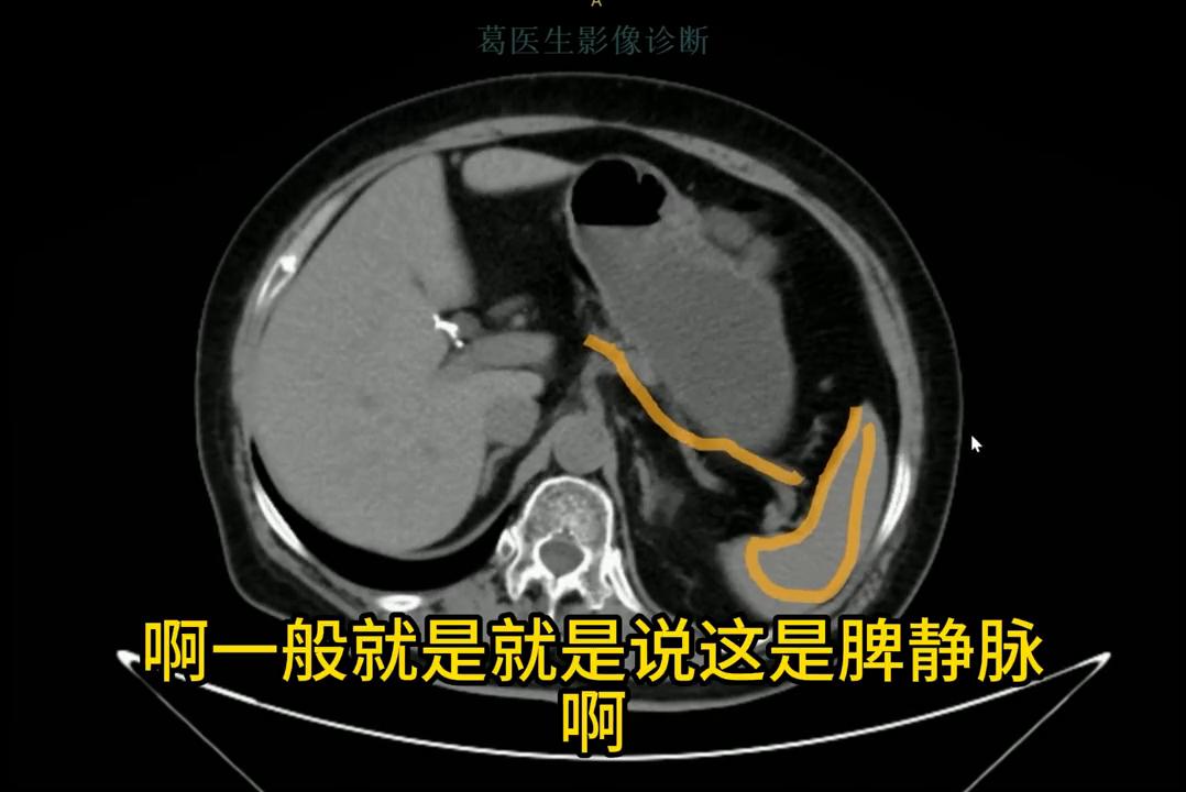 手把手教你看肺ct片,手把手带你看ct腹部