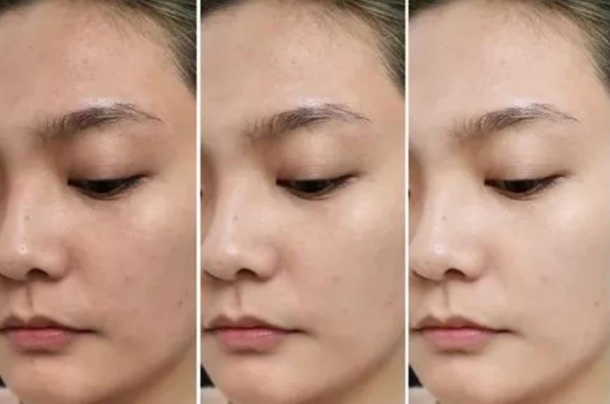 黄皮女生美白的正确思路,让黄皮变白的护肤方法是什么