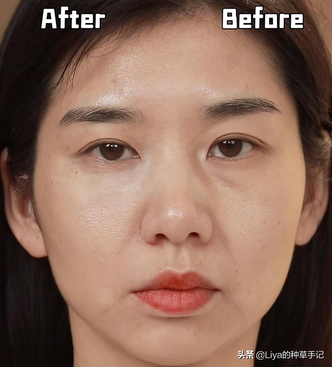 扁平脸如何拯救,扁平脸修复方法图解