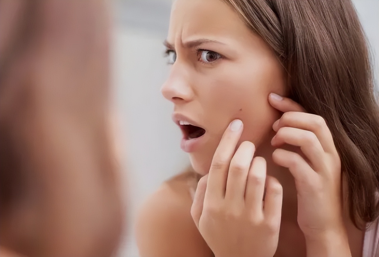 女生一来例假就长痘是什么原因,女生姨妈来了爆痘怎么办