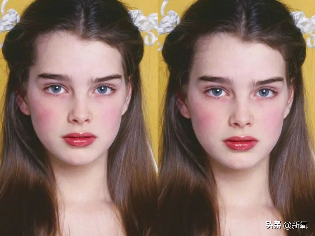 高颅顶怎么掩饰发际线,高颅顶会显得发际线低吗