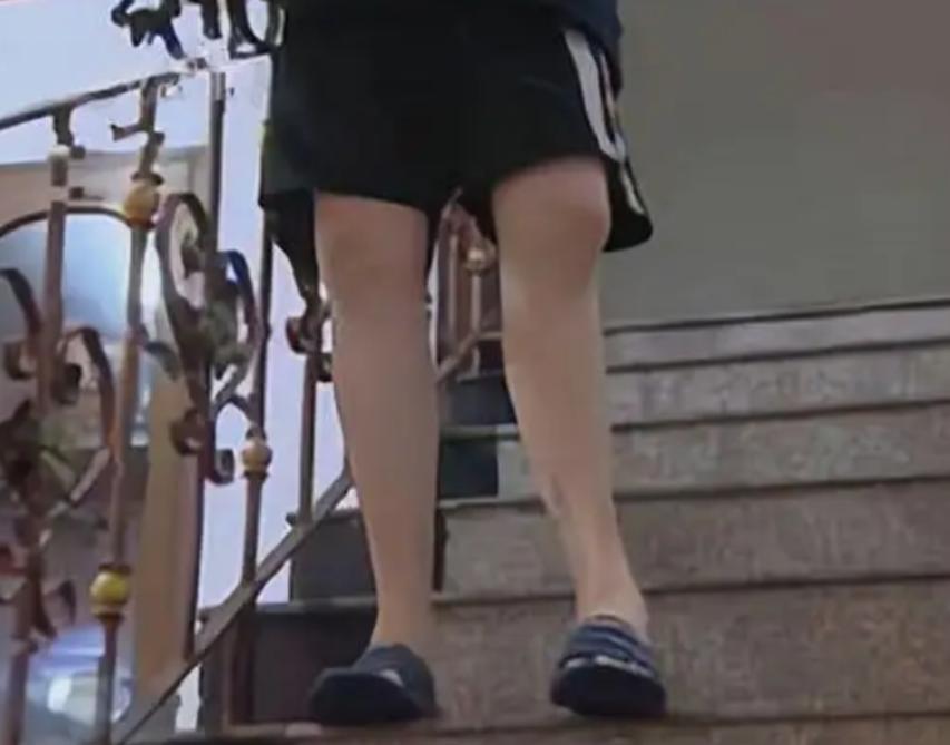 李亚诺中国断骨增高第一人,当年花16万断腿增高