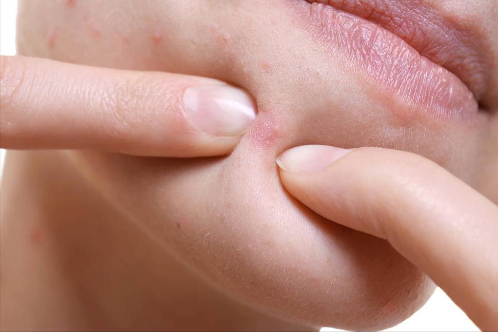 痘痘在脸上哪些位置代表什么,痘痘长在脸上不同位置代表什么