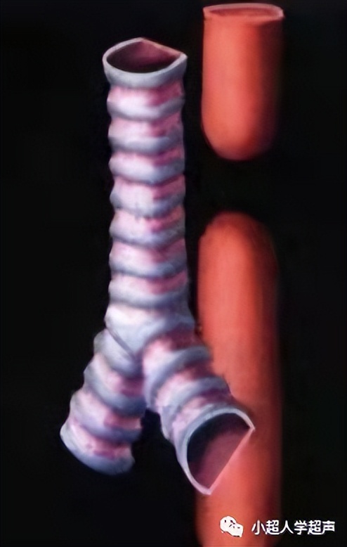 超声影像小视频,食道闭锁超声表现