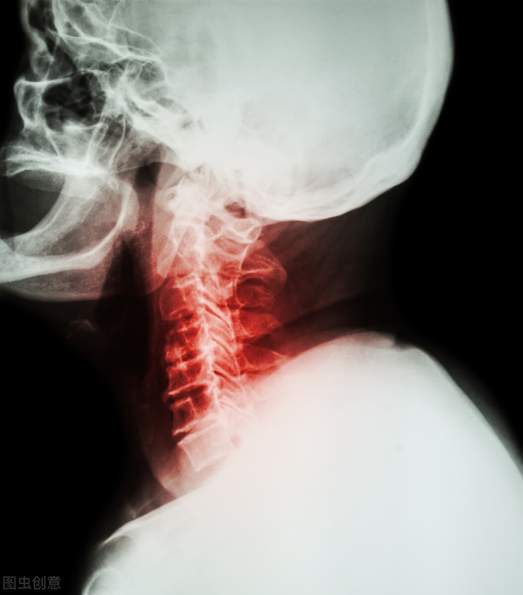 颈椎病会引起疾病怎么治疗,颈椎病导致心脑血管疾病