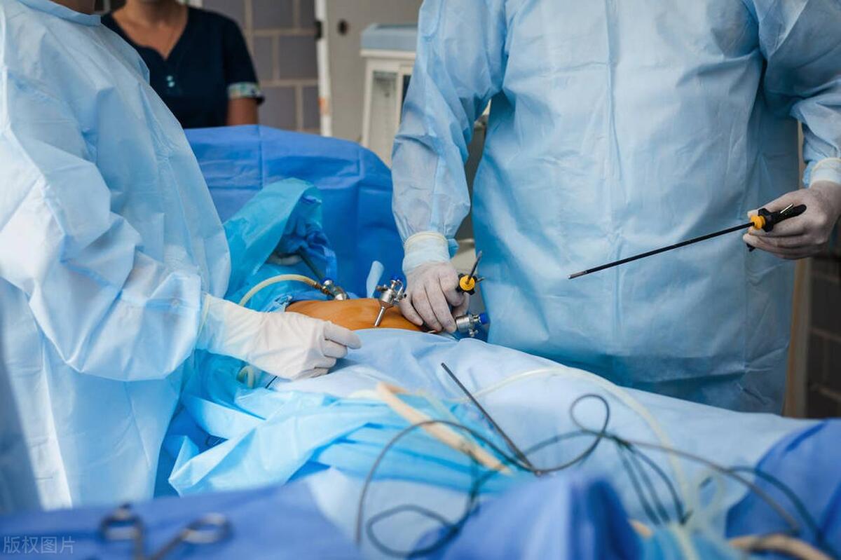 女性阴挺是什么情况？会影响身体健康吗？需要治疗吗？