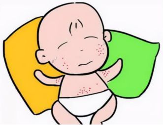 夏天脖子上起的是痱子还是湿疹呢,夏季孩子湿疹痱子不断