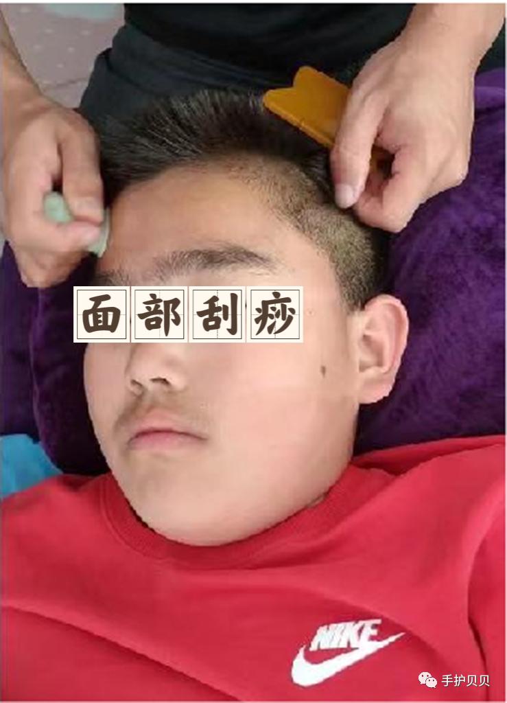 儿童有慢性鼻炎能做腺样体手术吗,腺样体肥大手术鼻炎还会复发吗