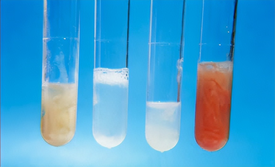 新冠疫情下，我们抗击耐药结核病变得更加艰难