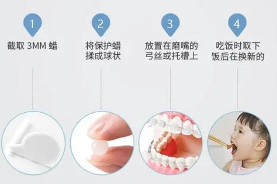 正畸治疗须知,正畸有哪些注意事项
