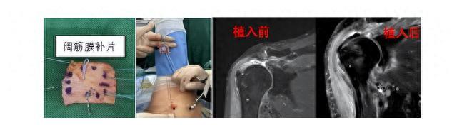 mrna疫苗的研发历程,mrna疫苗的发展趋势