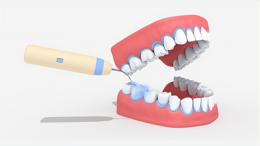 超声波洁牙后牙齿缝隙大怎么办,超声波洗牙后牙缝变大会修复吗