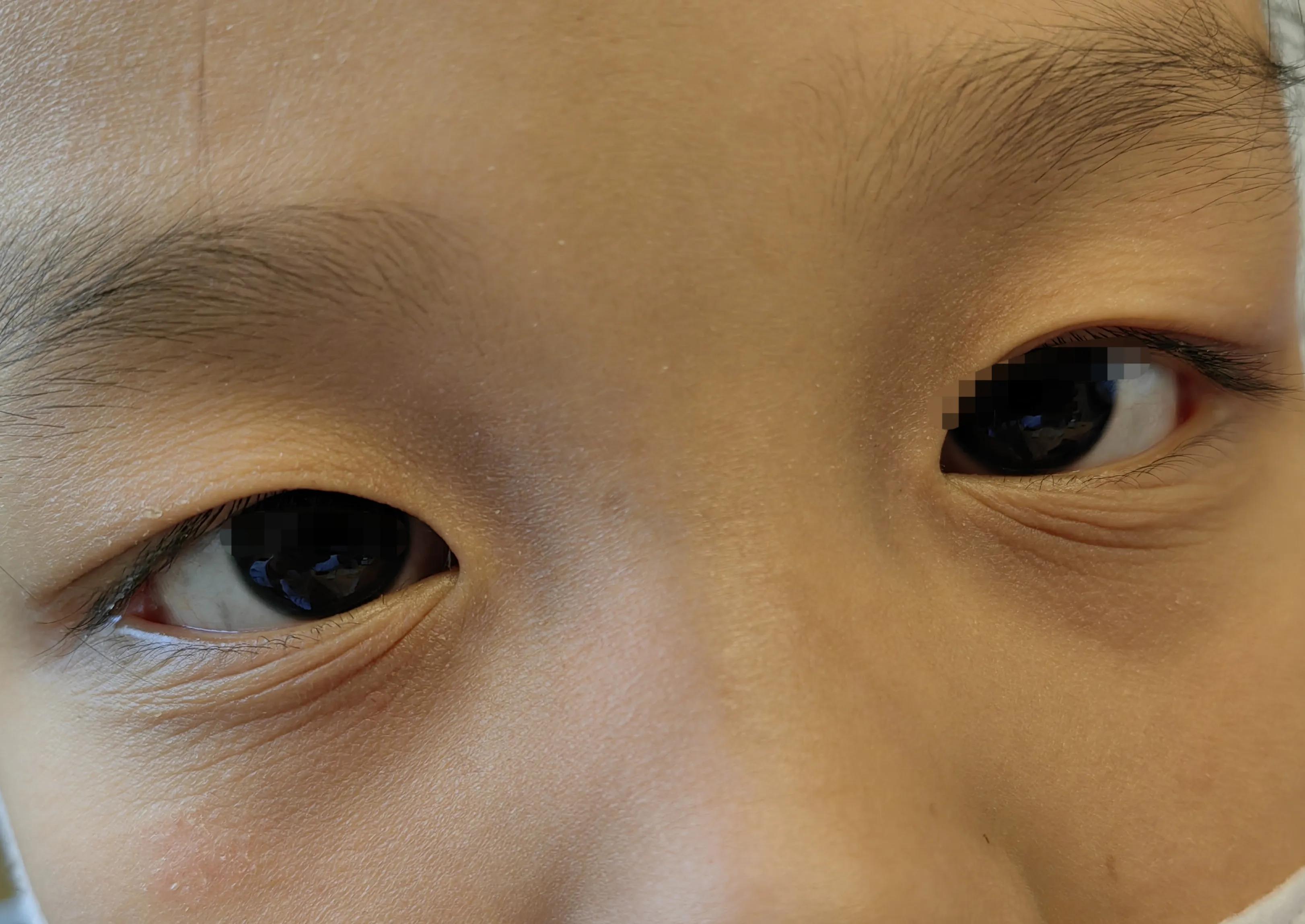 女人出现黑眼圈的原因,出现黑眼圈是怎么回事