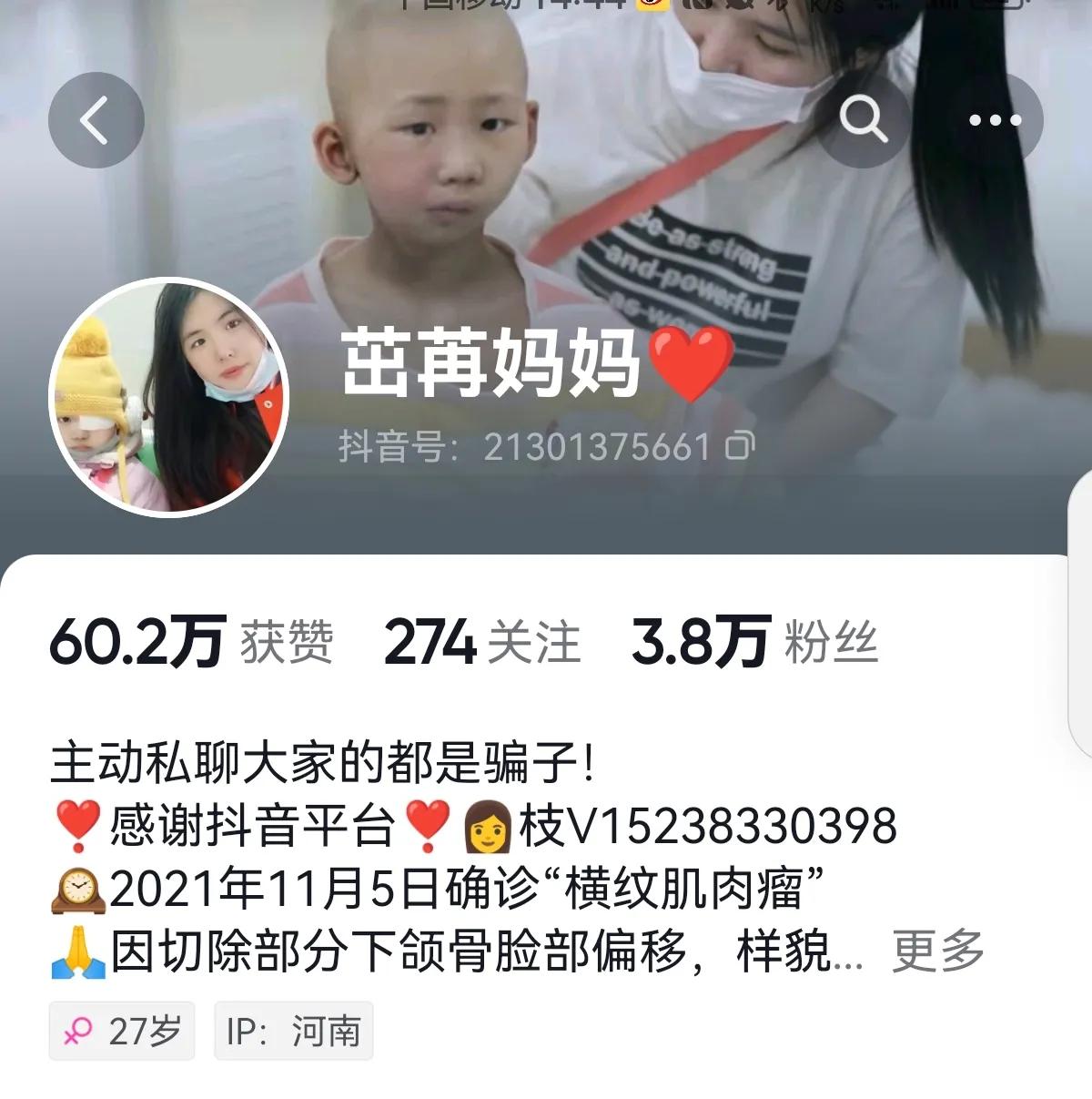 孩子腮腺淋巴结炎一直反复,儿童脸部淋巴结发炎一个大包
