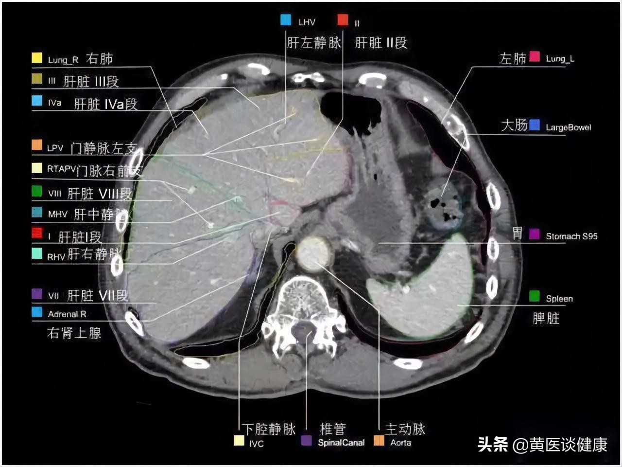 乙肝小三阳门静脉增宽16能活多久,抗病毒1年反而肝纤维化严重了