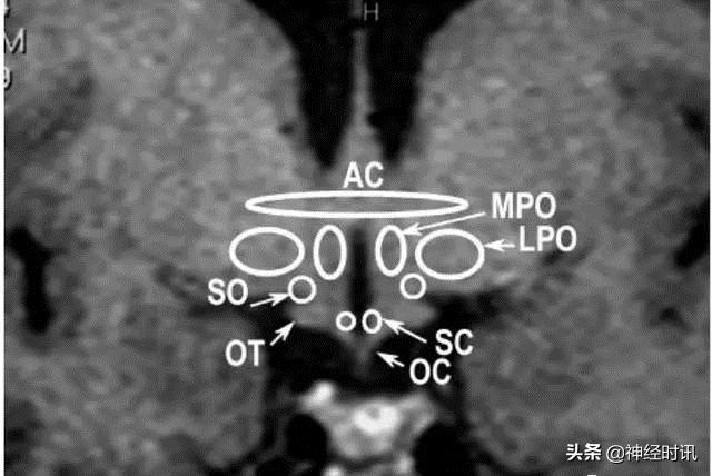 下丘脑及垂体解剖结构,下丘脑解剖和机能特点英文版