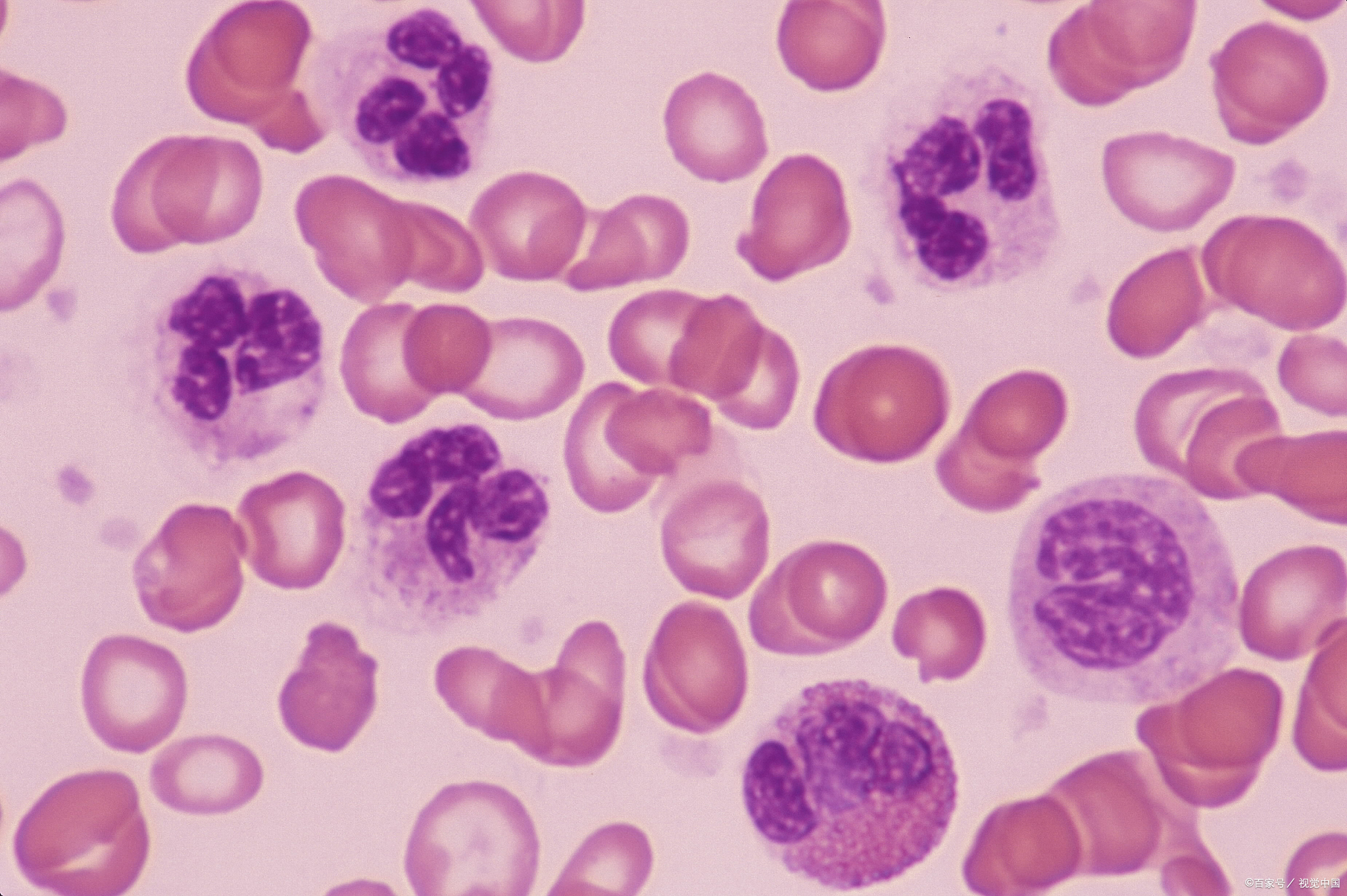 卵巢早衰病因复杂,女性患有卵巢早衰主要表现是什么