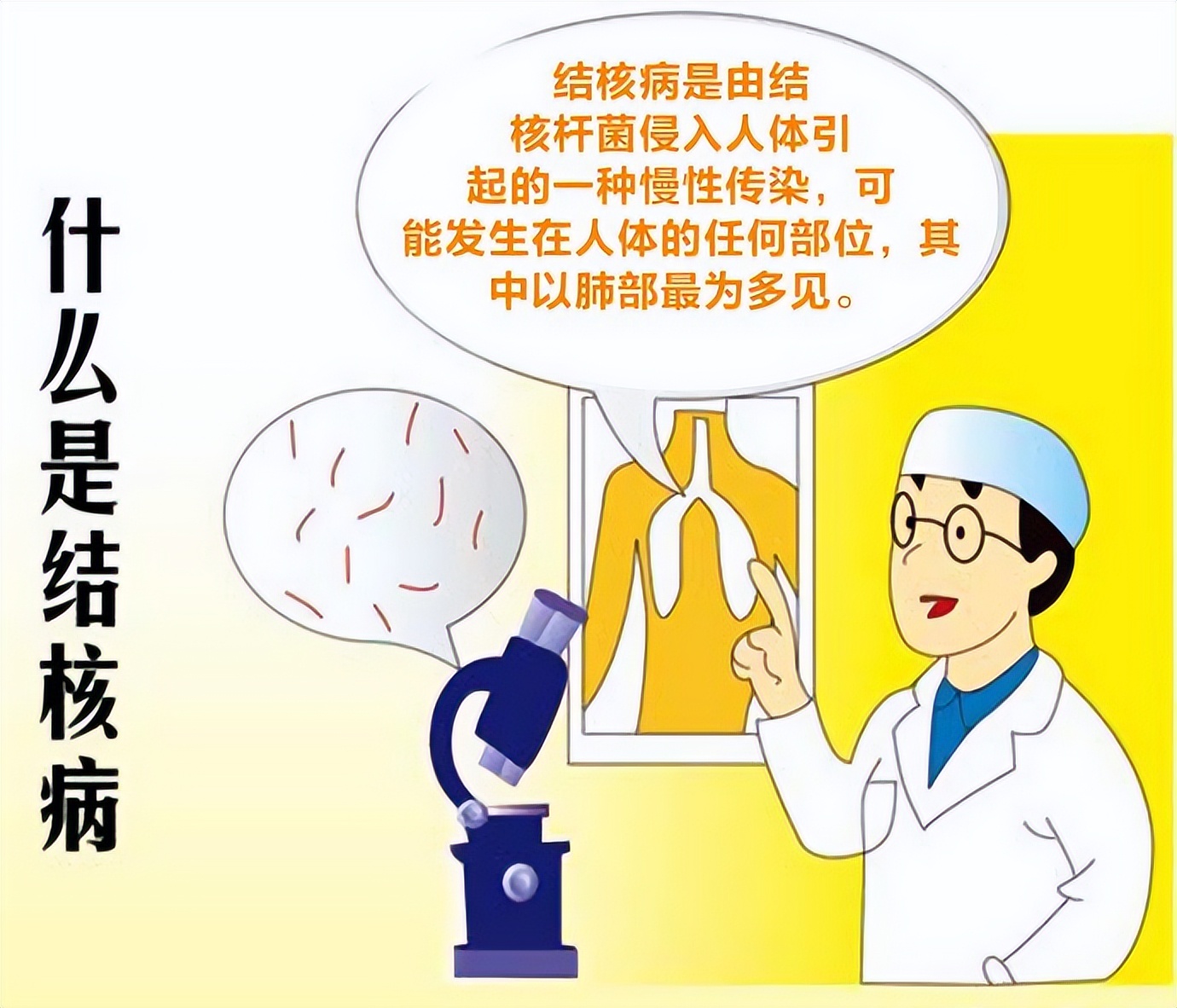 不止有肺结核，泌尿系统也会有结核病