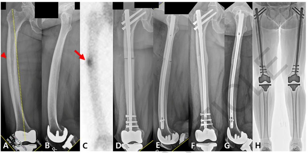 楠ㄧ闄堝崕,闄堝崕鍦ㄥ尰闄㈢殑瑙嗛