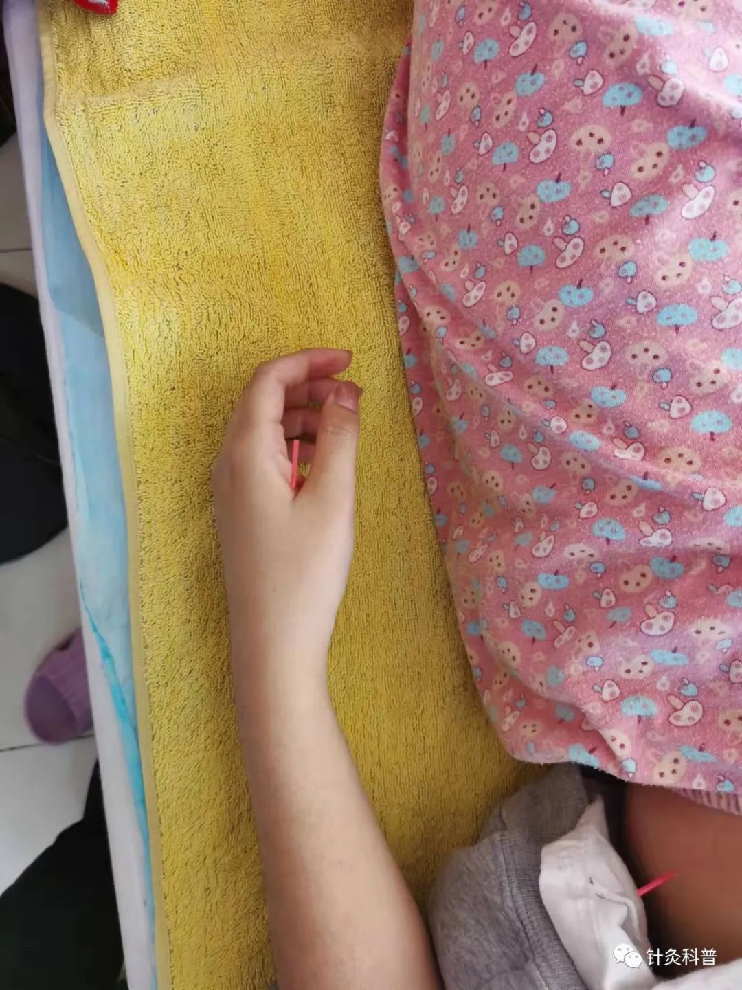 针灸治病治愈案例,针灸治疗妇科杂病视频