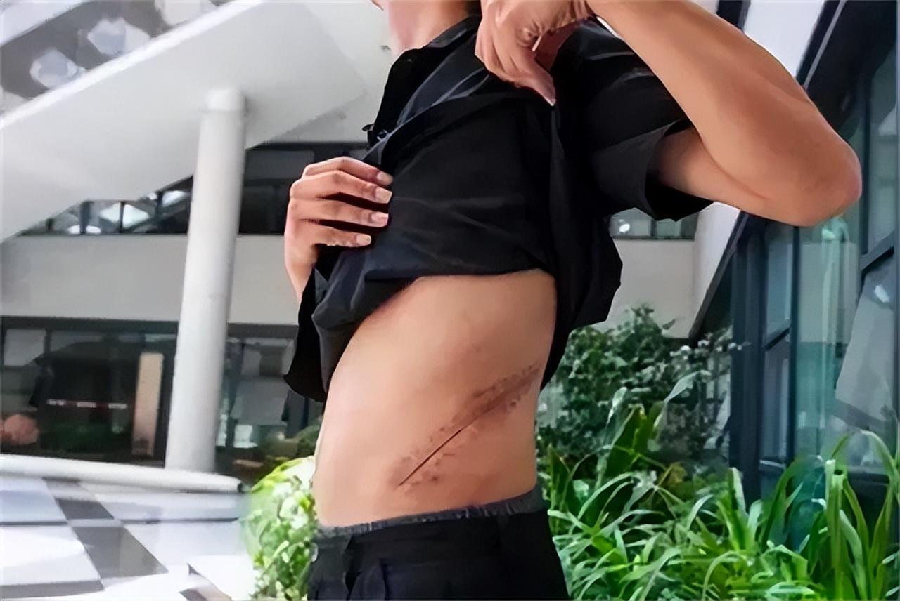 11年前卖肾小伙现状,10年前为了苹果手机卖肾的男孩