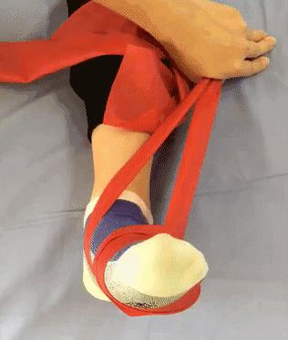 脚踝足内翻可以恢复吗,后天足内翻走路姿势