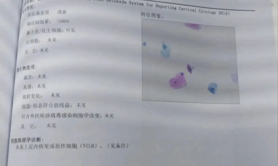 hpv病毒cin3可怕吗,58型号hpv病毒可怕吗