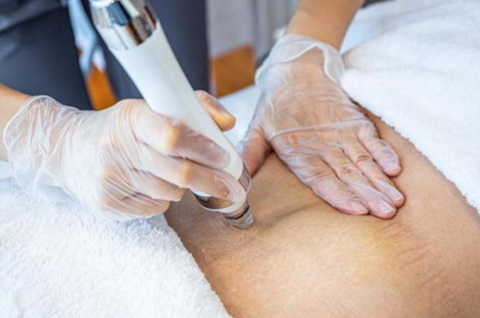 医生坦言：女人生没生过娃，一眼就能看出来，这3点不同很明显！