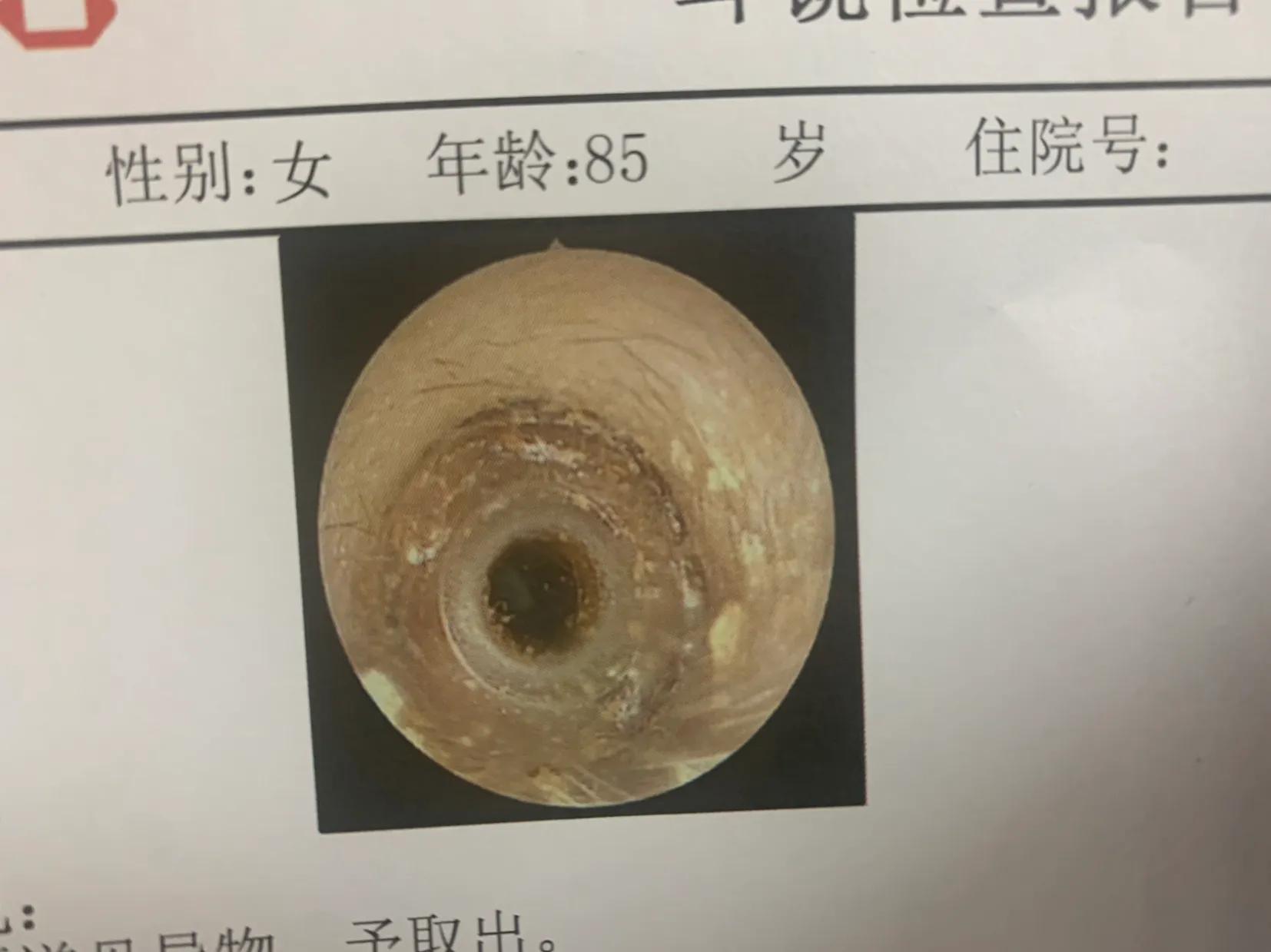 小东西解决大烦恼,小东西太多怎么解决