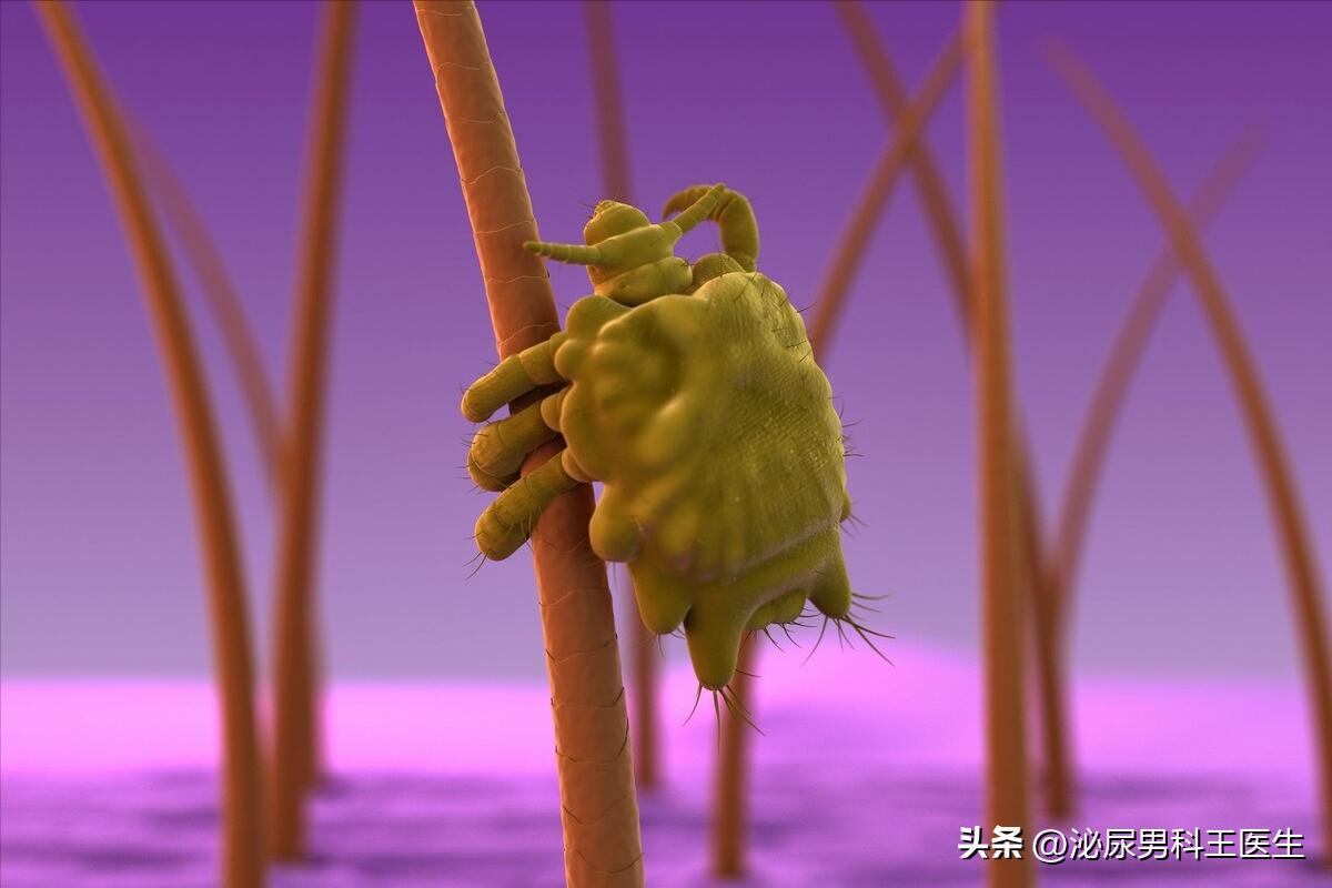 阴虱是什么？为什么现在很多人得阴虱？医生：离不开3个传播途径