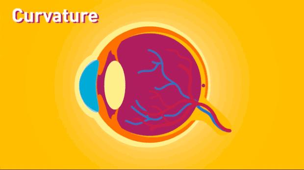 近视手术和白内障手术原理一样吗,激光治近视的原理是什么