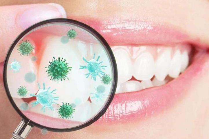 吸烟黑牙怎么去除,怎么抽烟减少牙垢