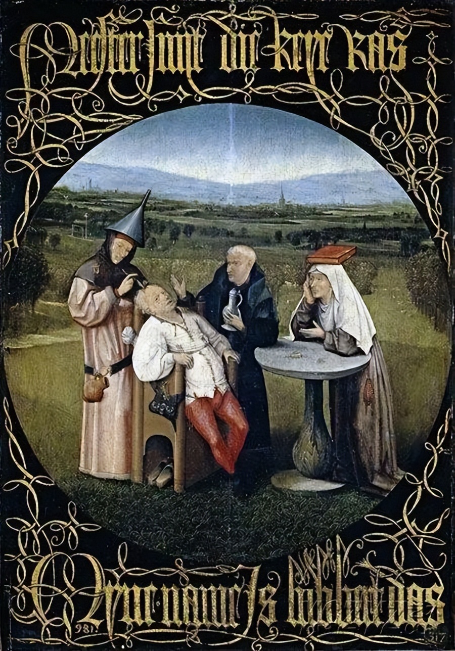 开颅手术脑洞大开,欧洲古代放血灌肠疗法