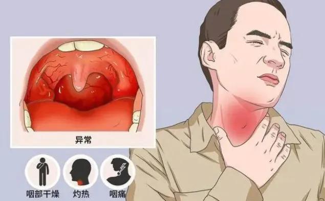 二阳来了家里应该备点什么药,预防二阳家里要备什么药